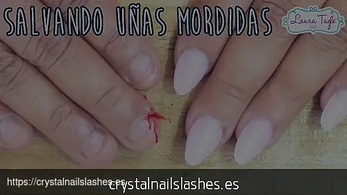 como crecer las uñas mordidas antes