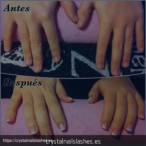 como crecer las uñas mordidas antes