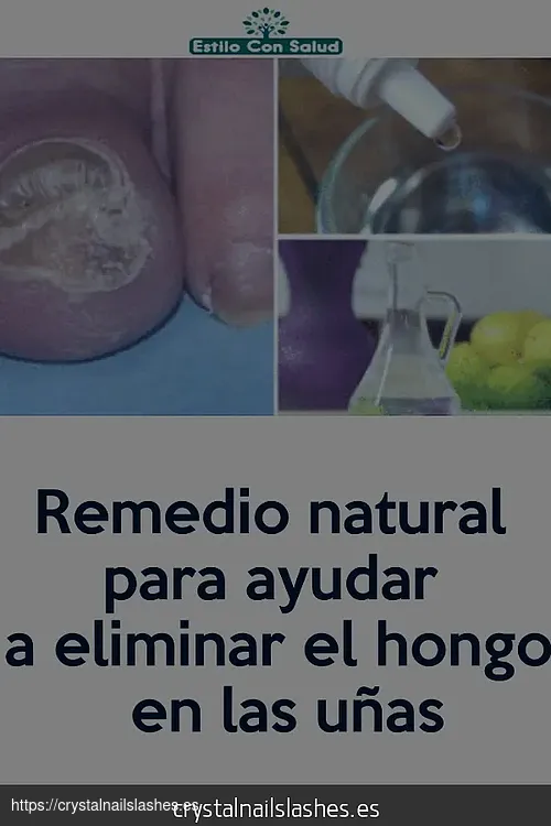 cómo quitar los hongos de las uñas delas manos