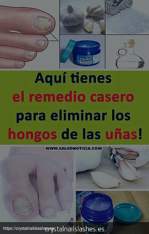 como quitar uñas acrílicas remedio casero