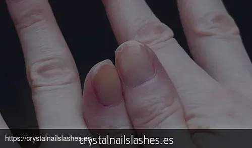 endurecer las uñas frágiles y escamadas