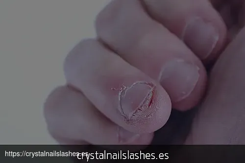 porque me como las uñas