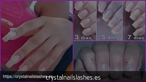 porque me como las uñas