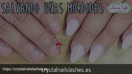 porque me como las uñas revelan enfermedades