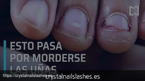 porque me como las uñas y me muerdo los labios