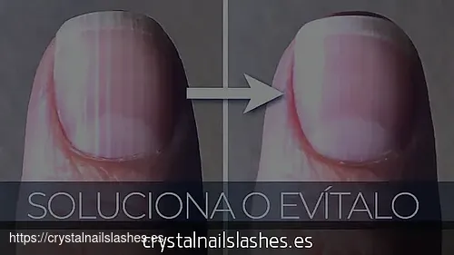 porque me crecen las uñas tan rapido