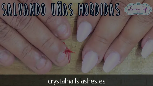 como crecer las uñas mordidas antes