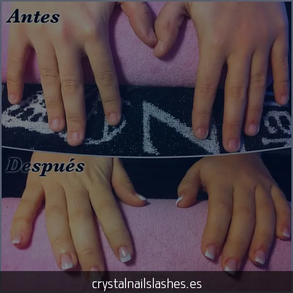 como crecer las uñas mordidas antes