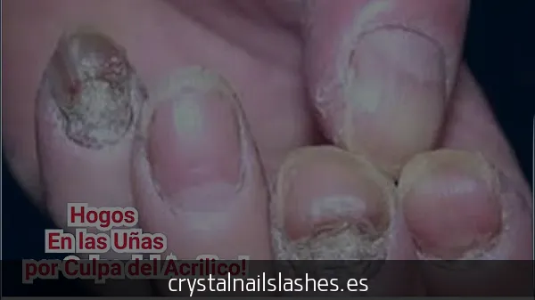 como fortalecer mis uñas despues de acrilico