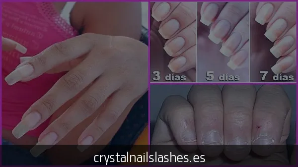 porque me como las uñas revelan enfermedades