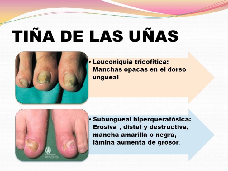 Betting_websites_and_apps_como_quitar_unas_de_gel_sin_aluminio_1.jpeg